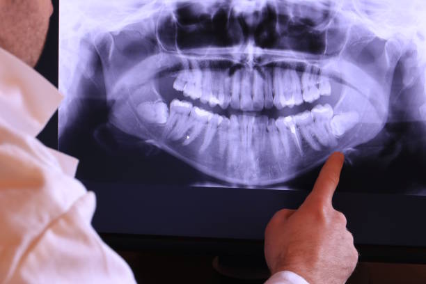 Best Emergency TMJ Treatment in Sullivan, MO